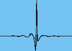 Interferogramm